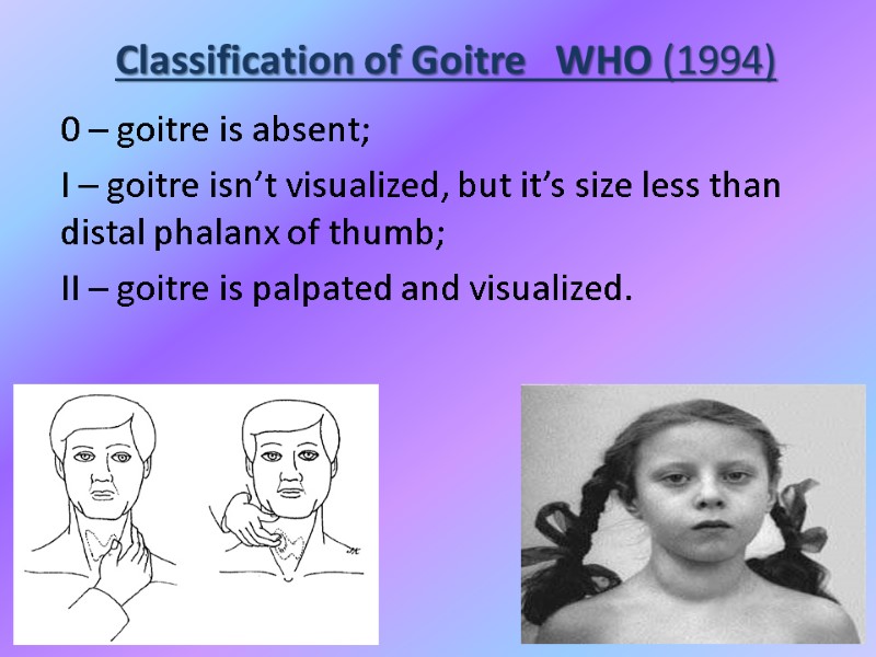 Classification of Goitre   WHO (1994) 0 – goitre is absent; I –
